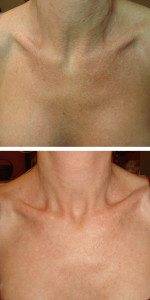 neck & chest photo 8